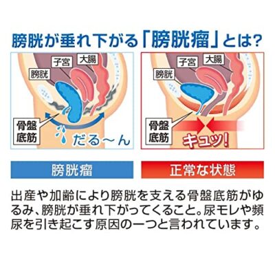 [一般医療機器]　骨盤底筋ベルト モレナレディEX