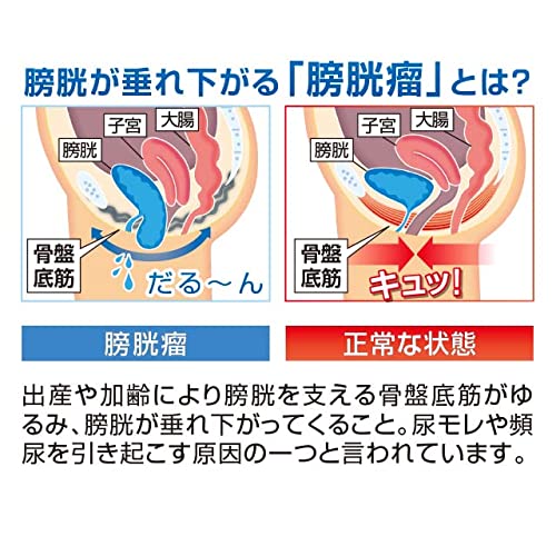 [一般医療機器]　骨盤底筋ベルト モレナレディショーツ